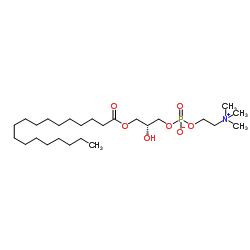 1-硬脂酰-SN-甘油-3-磷酰胆碱结构式