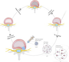10.1016/j.nano.2017.11.011 picture